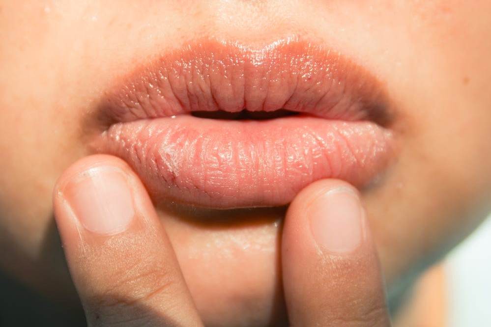 嘴唇保養的「3不」關鍵：不要撕除死皮、不要過度舔抿嘴唇、不要抽菸 尤其是抽菸是讓唇紋加深的原因，會使得嘴唇失去彈性而暗沉