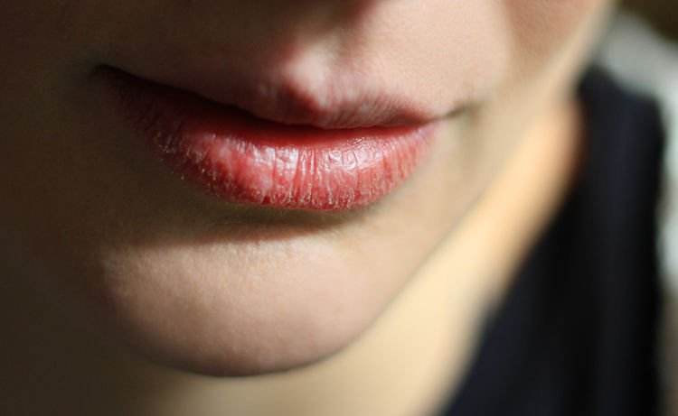 紫外線會造成肌膚光老化，嘴唇也不例外。沒有角質層的保護，嘴唇肌膚比臉部其他部位更脆弱，一旦忽略了防曬，輕則乾燥脫皮，嚴重可能使得唇紋加深、唇周產生細紋暗沉、甚至唇色變深。
