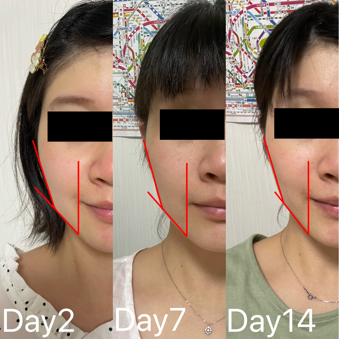 開箱】用ReFa CARAT 白金美容滾輪按摩，真的能成功拉提、消水腫、瘦臉嗎？(14天實測)– 找Cha研究室