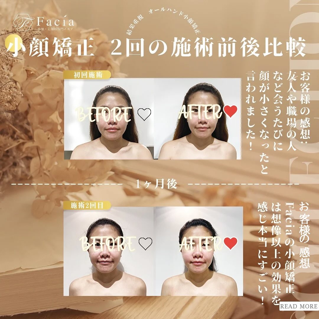 Facia小臉按摩課程 前後對比