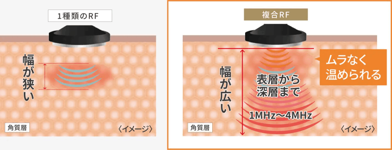 Photo Plus Deep Lift DEEP LIFT 說明